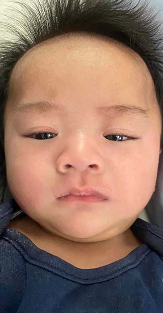After treatment