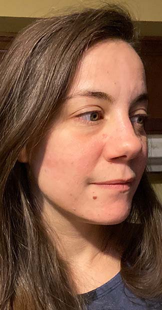 After treatment