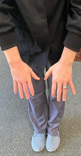 After treatment