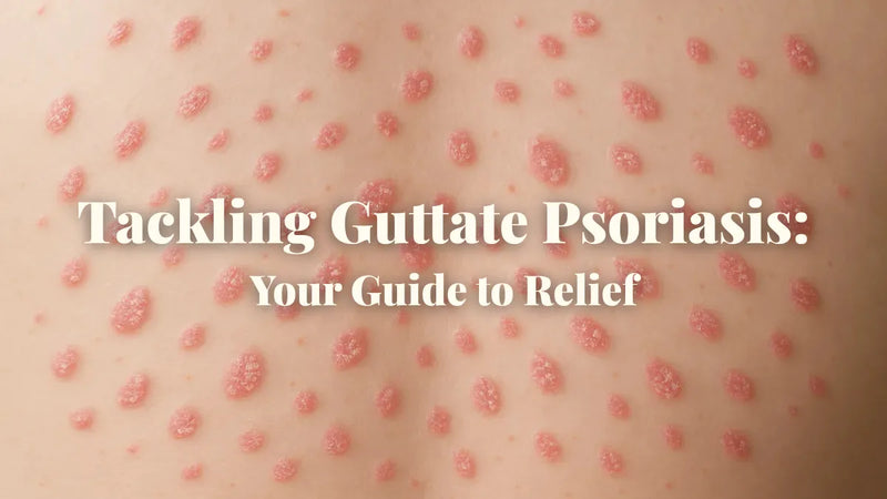 Guttate Psoriasis: Treatments That Actually Work