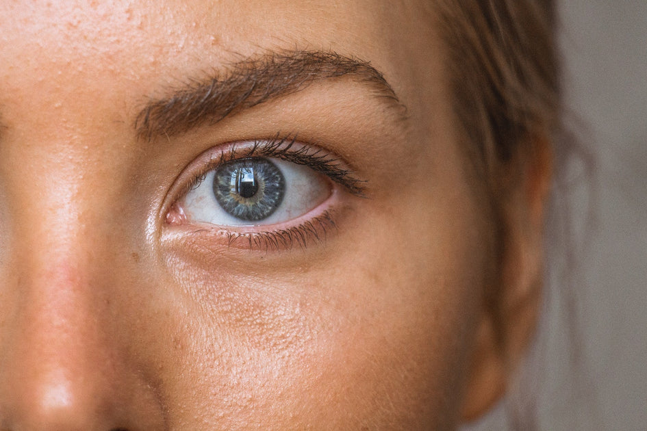 Everything You Need to Know About Seborrheic Dermatitis