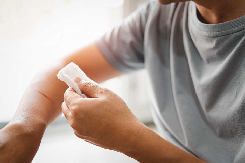 Nummular Eczema: Why Those Coin-Shaped Rashes Won't Heal