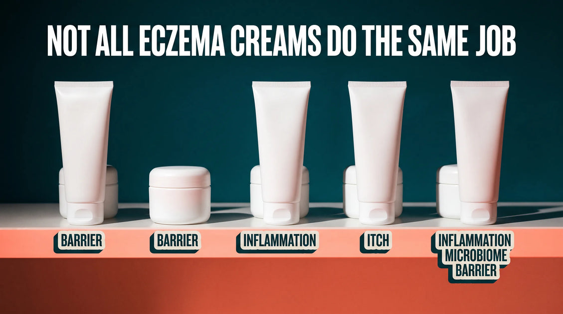 Creams for Eczema Over the Counter: 5 Types Compared