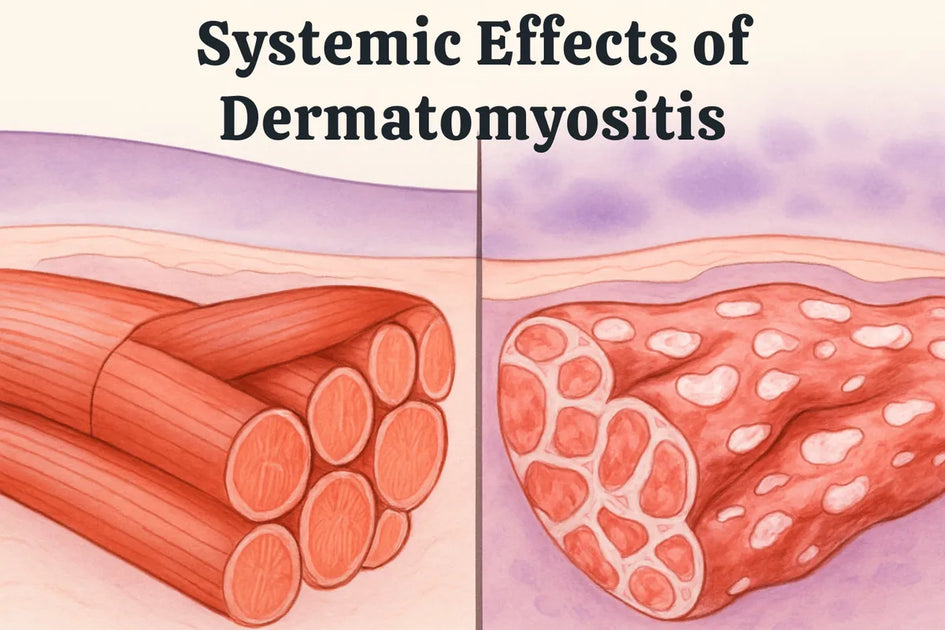 How Does Dermatomyositis Affect the Body: A Complete Guide