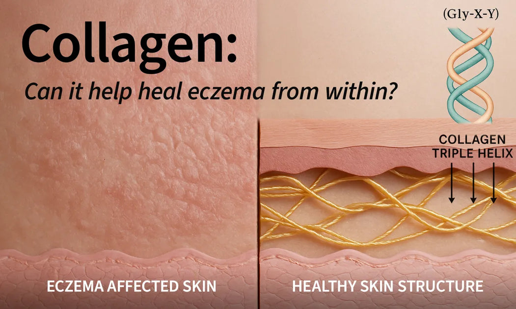Does Collagen Help Eczema? The Science Behind This Popular Supplement