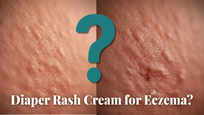 Does Diaper Rash Cream Help Eczema? Evidence-Based Guide