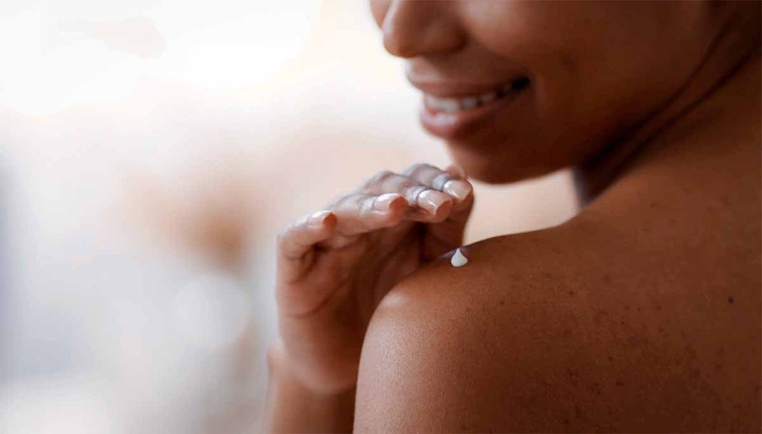 Why Does Eczema Cream Sting? Understanding the Burn