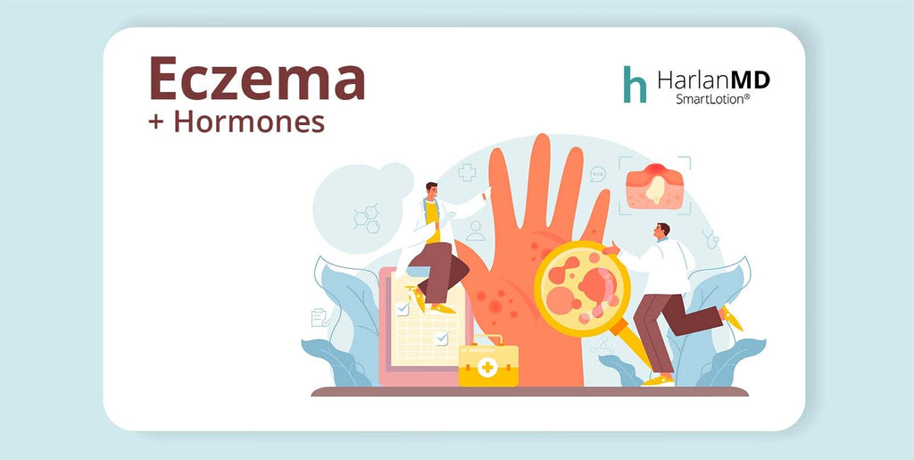 Do hormones cause eczema? a graphic inviting to article