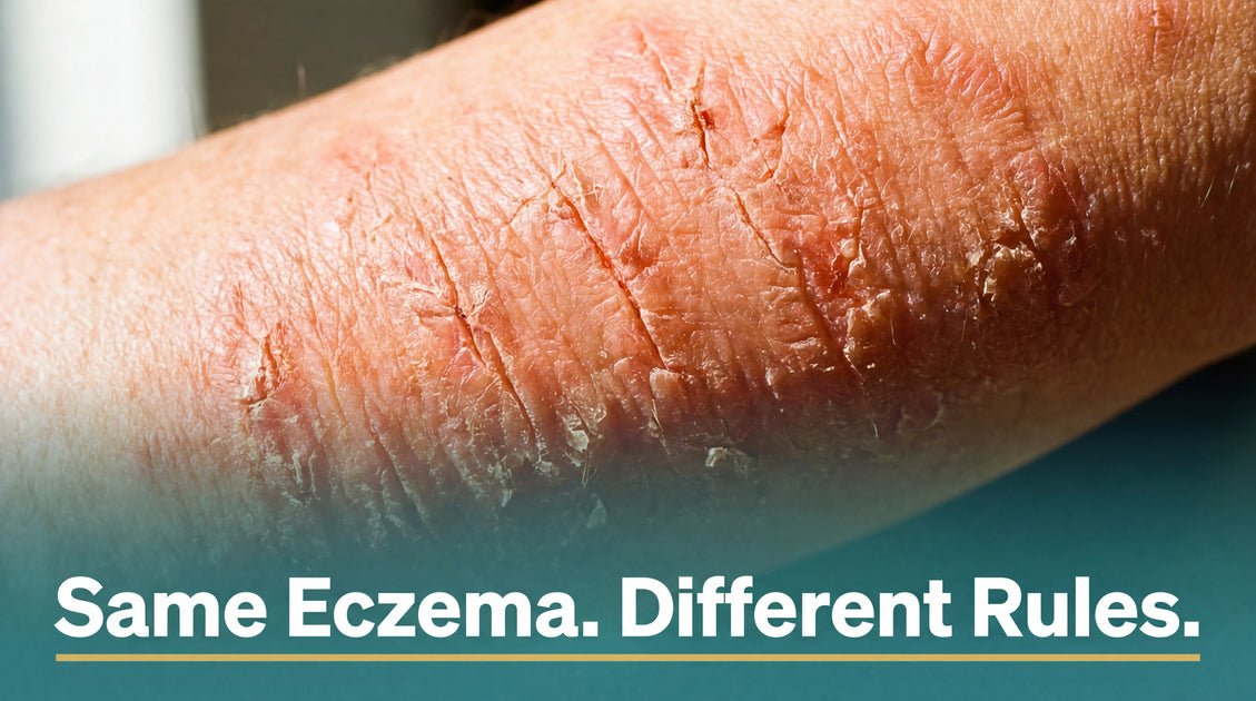 Eczema on Body: Location Guide for Every Affected Area