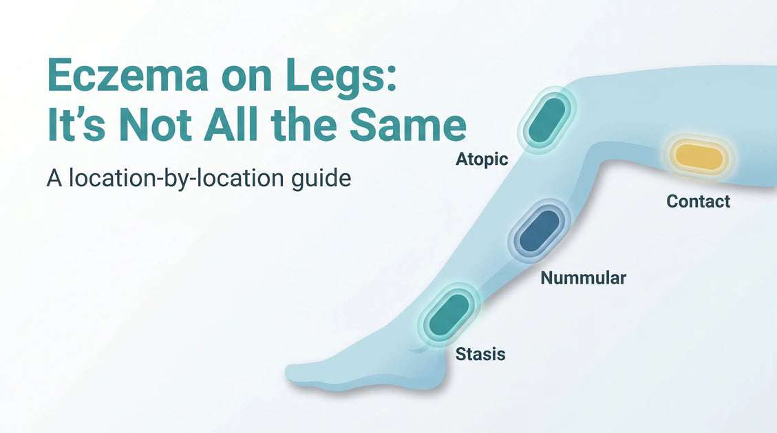 Eczema on Legs: Causes, Pictures & How to Treat It