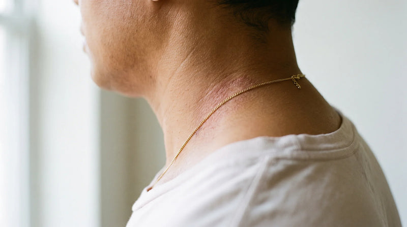 Eczema on neck showing irritation zones under a collar and necklace