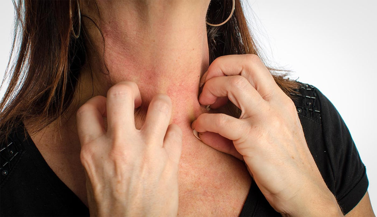 Is Eczema A Disability Condition And Protocols Examined is-eczema-a-disability-condition-and-protocols-examined