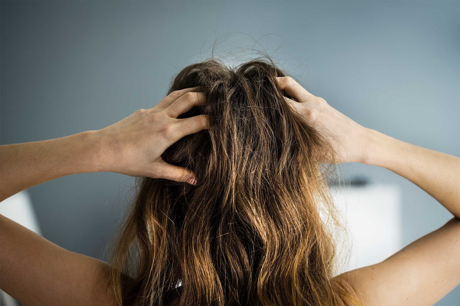 Applying Eczema Cream to the Scalp