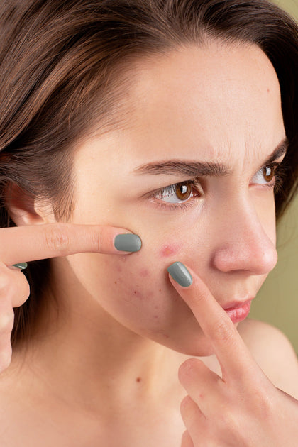 Understanding Atopic Dermatitis & Its Treatment Options