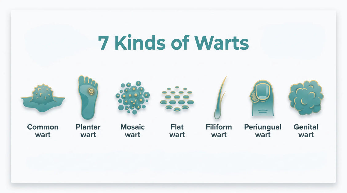 Kinds of Warts: 7 Types, Pictures & How to Identify