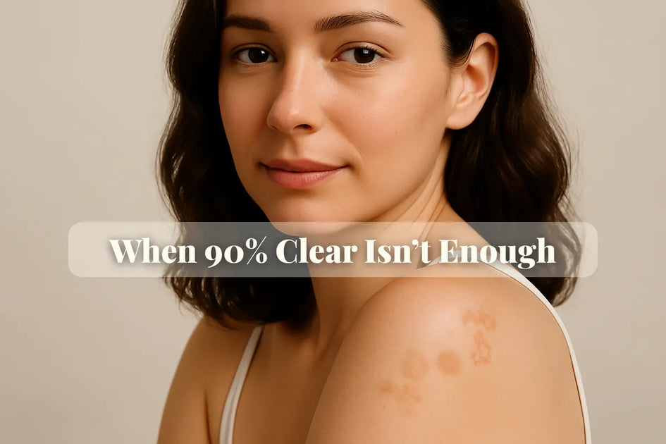 Leftover Eczema: Why Patches Won't Clear & Solutions