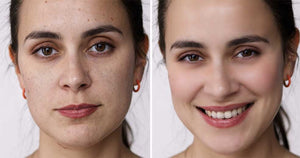 Why Is My Skin So Dry When I'm Moisturizing?