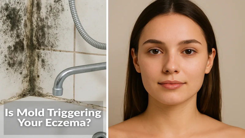 Mold Triggering Your Eczema? Here's What Actually Works