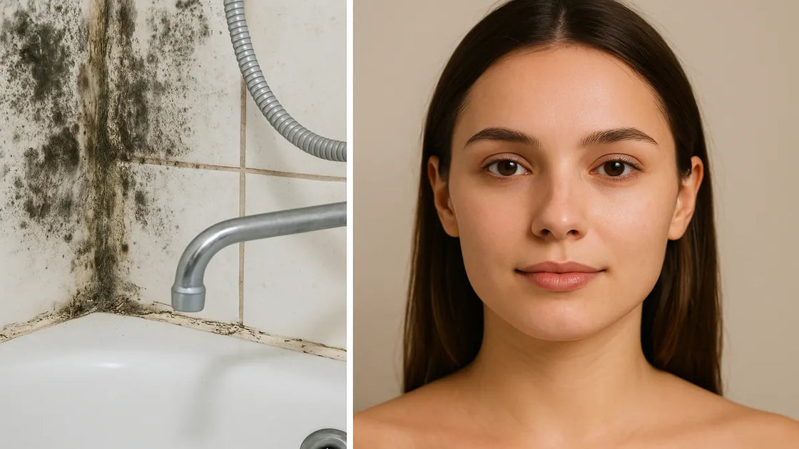 Mold Triggering Your Eczema? Here's What Actually Works