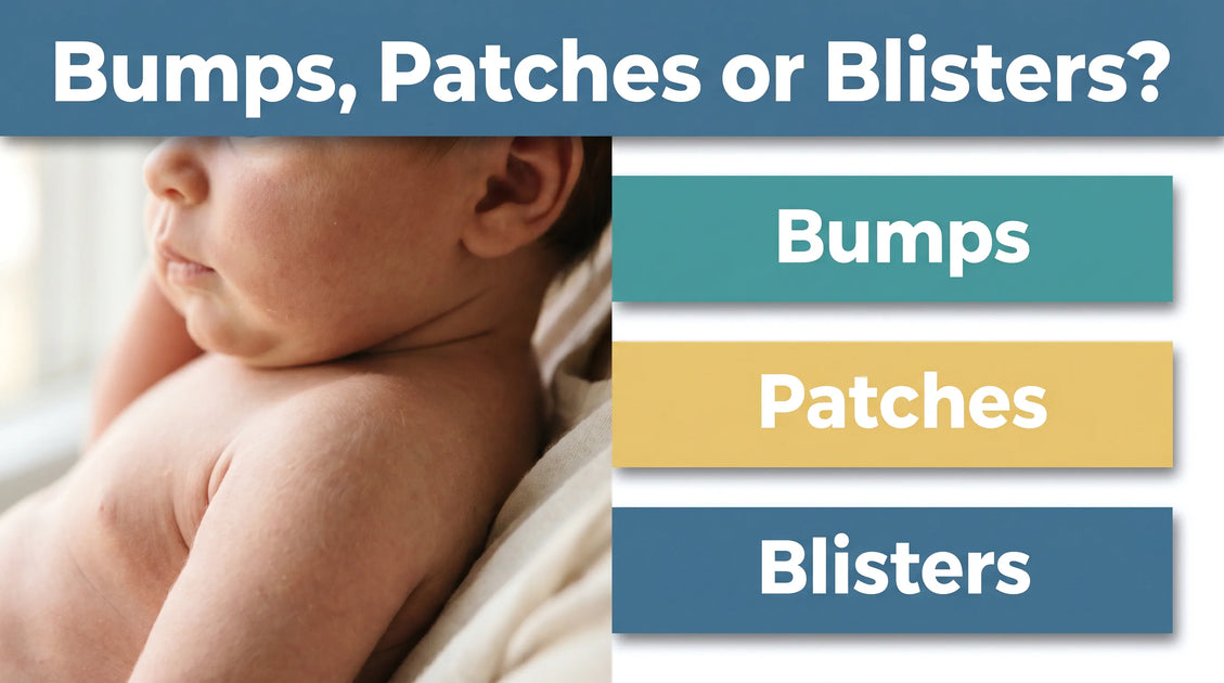 Newborn Skin Rash: Types, Causes & When to Worry