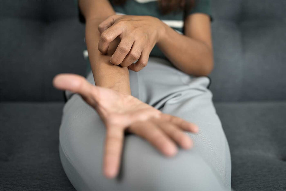 Can Eczema Spread?