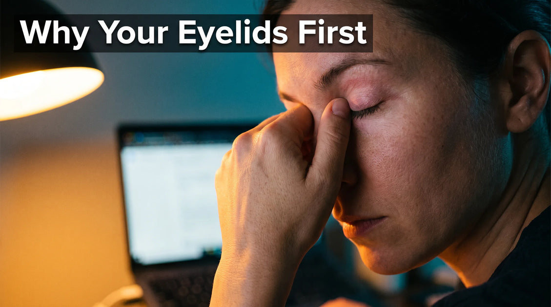 Stress Eczema on Eyelids: Why Stress Shows Up on Your Lids First
