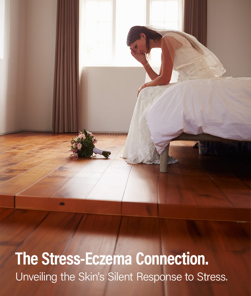 What To Do If You Have Eczema on Your Wedding Day: Our Definitive Guide