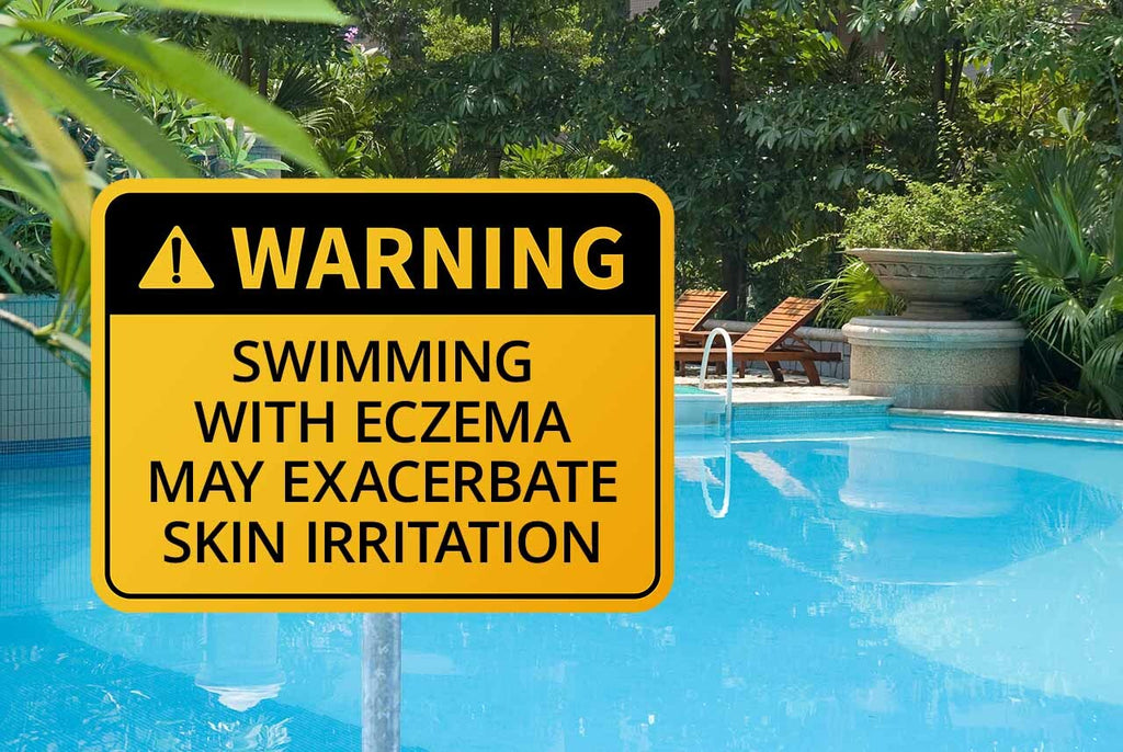 What You Should Know About Swimming and Eczema