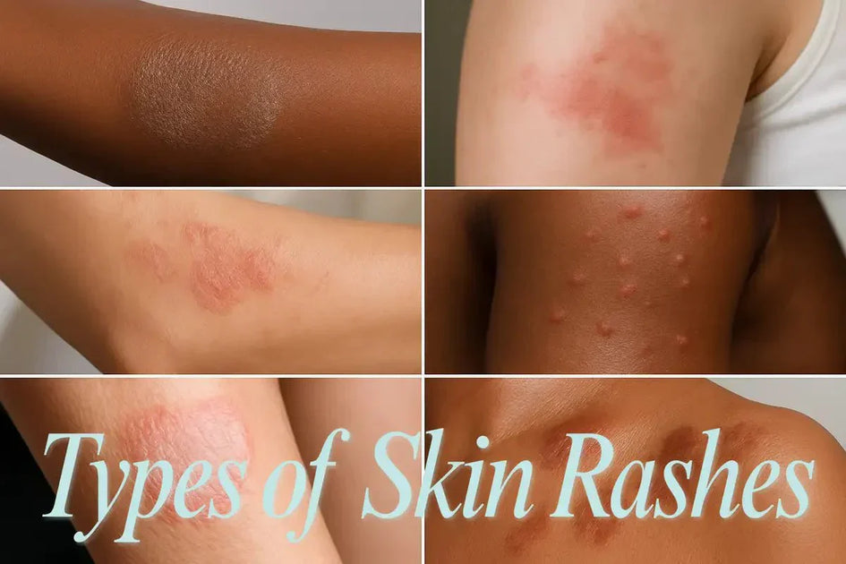 Types of Skin Rashes: A Guide to Identification and Treatment | HarlanMD